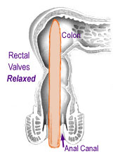 ppubo-rectal sling muscle relaxed