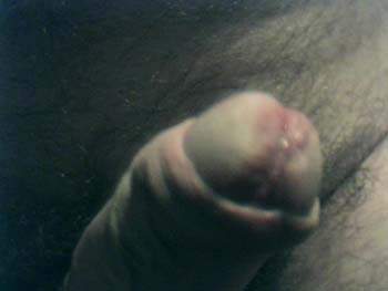 dick2