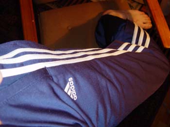 leg