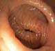 Rectal valve closed