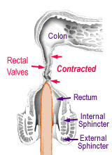 pubo-rectal sling muscle contracted