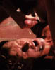 oral1