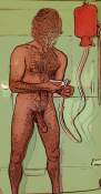 Male Enema
