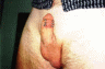 thm_prick15.gif